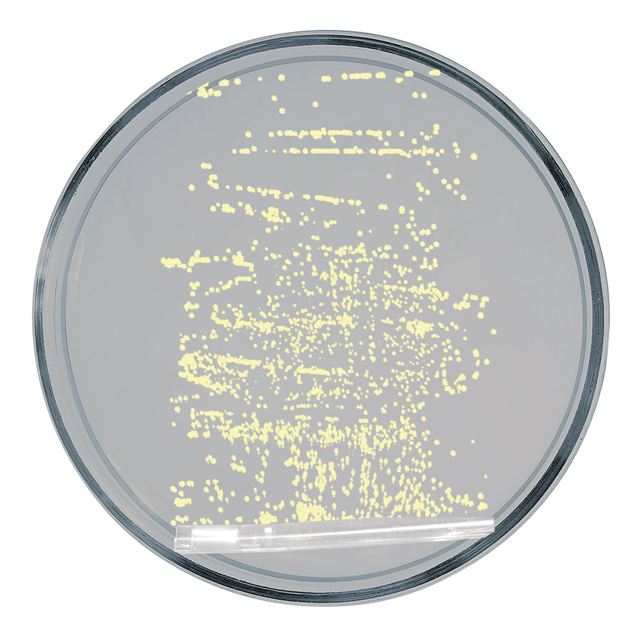 Petrischale Test herkömmlicher Katheter 3