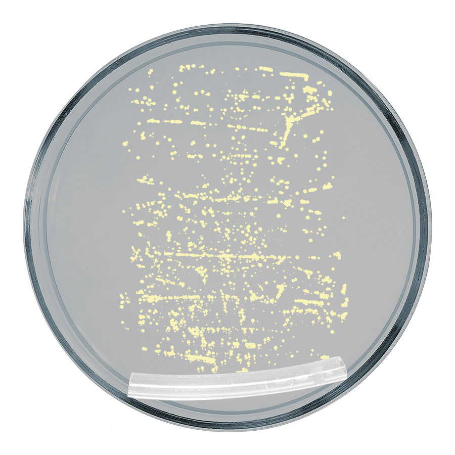 Petrischale Test herkömmlicher Katheter 2