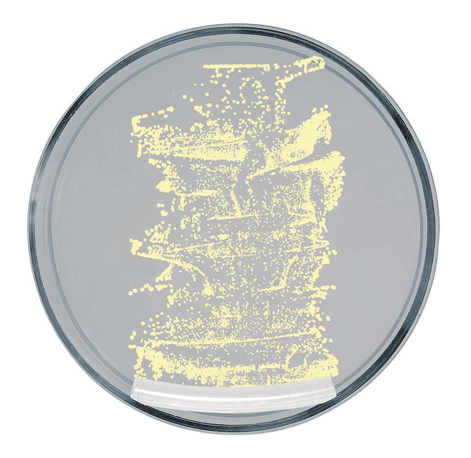 Petrischale Test herkömmlicher Katheter 1
